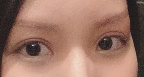 奥目と出目の特徴・見分け方・違い 】実際の写真で解説